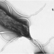 H. pylori under an electron microscope.